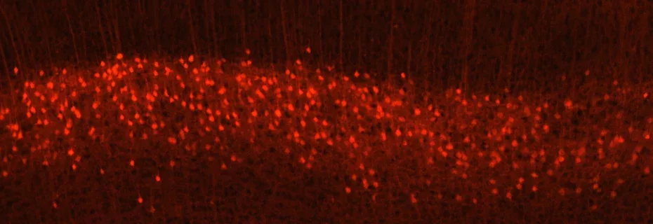 Rapid Prototyping Micro Holes in Glass Allows UC Berkeley Researchers to Study Neural Processes in the Brain